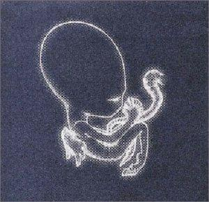 Sigur Rós "Agaetis Byrjun" #musik