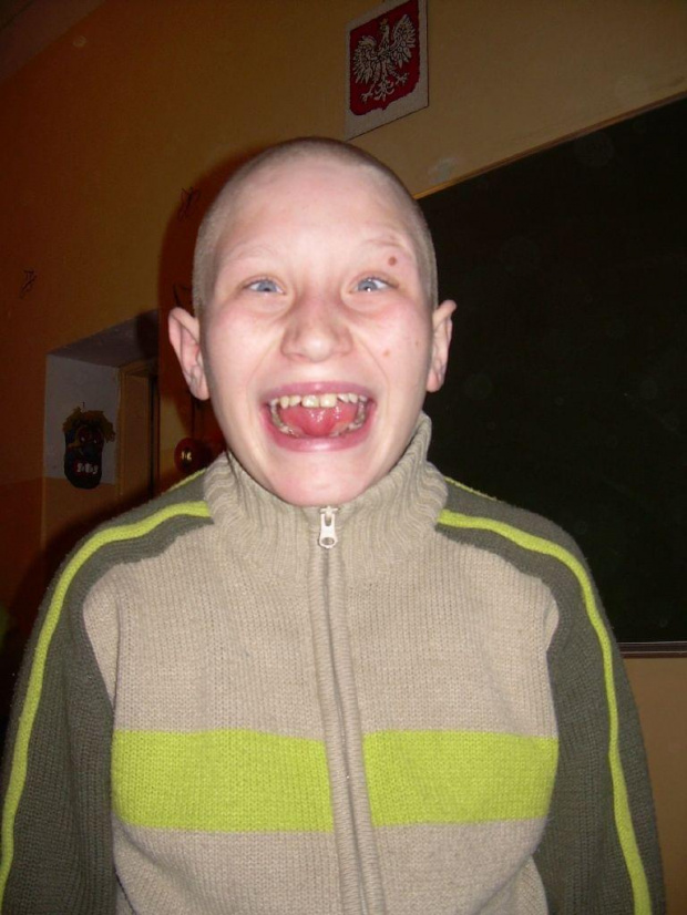 Maciek synku,co ci się stało w twarz?? #ShrekMarszałekNinjaSianów